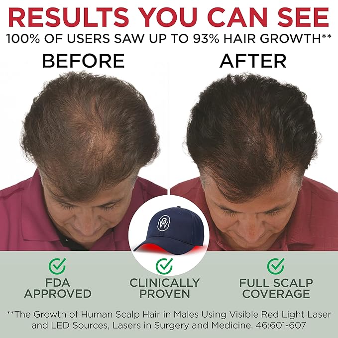 Red Light Therapy Hair Growth Cap – FDA Cleared Laser Treatment for Hair Regrowth and Reduced Shedding – LED & Laser Red Light Therapy Clinically Proven in Double-Blind Studies - Blue