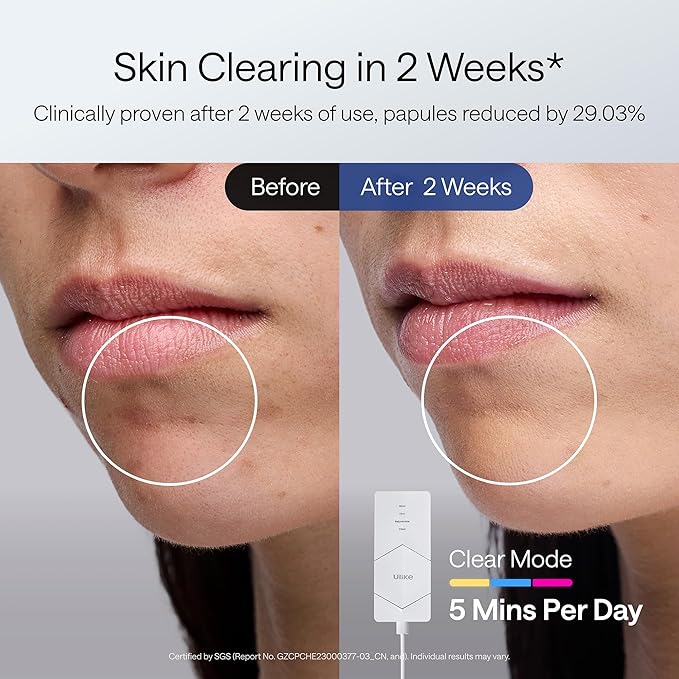 Ulike ReGlow LED Light Therapy Mask, Red Light Therapy for Face, 4 Modes with Red, Blue, Yellow & Infrared Red Lights for Reduce Acne & Anti-Aging, Eye-Protection, 272 Beads, Remote Control