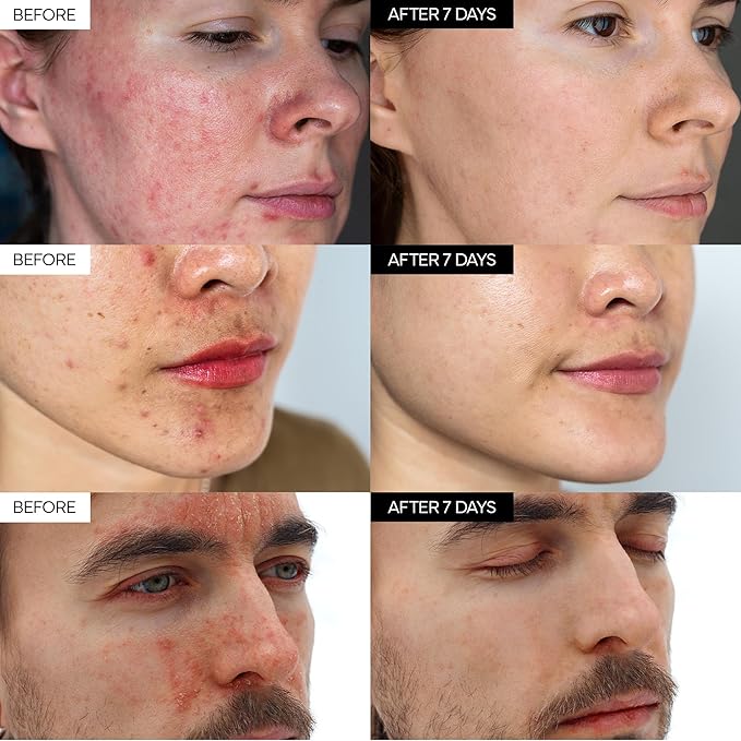 Intensive Cica Repair Cream, Korean Dexpanthenol cream, Ultra-Soothing & Hydrating Care Cream for Sensitive Skin with Madecassoside (1.76oz / 50g)