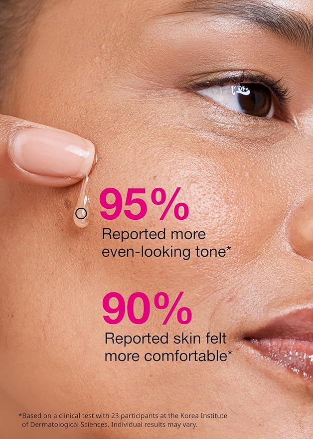 ISOI Blemish Care Up Serum for Face, Vegan Hydrating Serum for Smooth & Glass Skin Effect, Skin Barrier & Moisture Balance for Women, Arbutin & Rose Otto Oil, Korean Skin Care (1.18 fl. oz, 35ml)