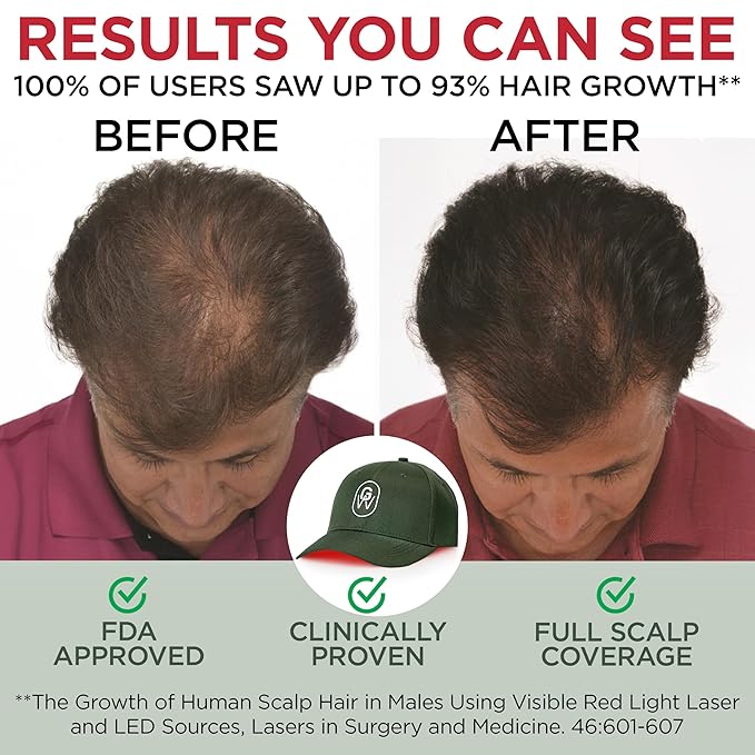 Red Light Therapy Hair Growth Cap – FDA Cleared Laser Treatment for Hair Regrowth and Reduced Shedding – LED & Laser Red Light Therapy Clinically Proven in Double-Blind Studies -Green