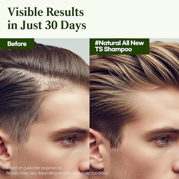 TS Natural All New TS Shampoo | Korean Shampoo for Sensitive Scalp | Hair & Scalp Care with Salicylic Acid and Natural Ingredients | Sulfate-Free Dandruff & Itchy Scalp Relief (16.9 Fl Oz / 500mL)