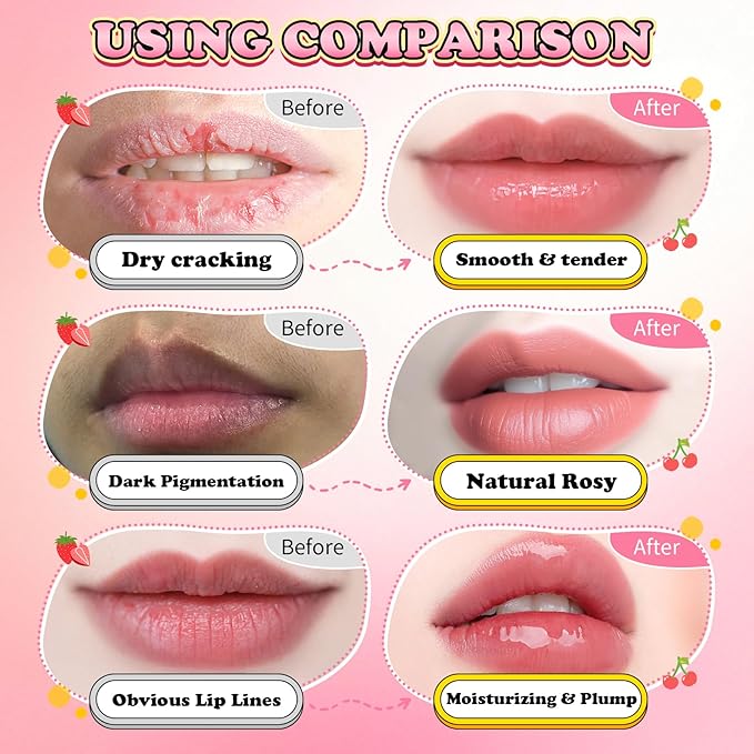 4PCS Lip Scrub and Mask Set,Cherry and Honey Pot Lip Balm,Strawberry and Watermelon Lip Exfoliator Scrub and Moisturizer,Repair Lips Sleeping Mask,Reduce Fine Lines Lips Care Set