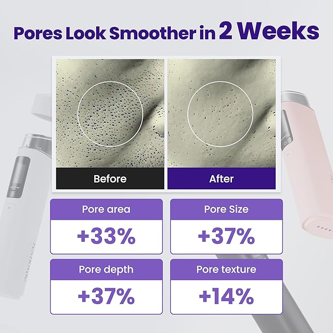 Core Impact – Face Massager for Sagging Skin, Boosts Skincare Absorption, Supports Radiant Glow and Lifting Effect (Pure White)