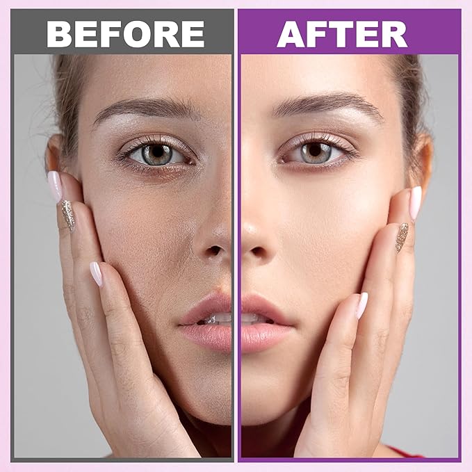 Skin Care Set,6 Pcs Anti-aging Skin Care Kit,Hydrate, Moisturize Skin,Facial Skin Care Routine Kit Women Teen Girls Travel Skincare Gift Set,Women Mom Gifts for Christmas Valentines Birthday Gift Her