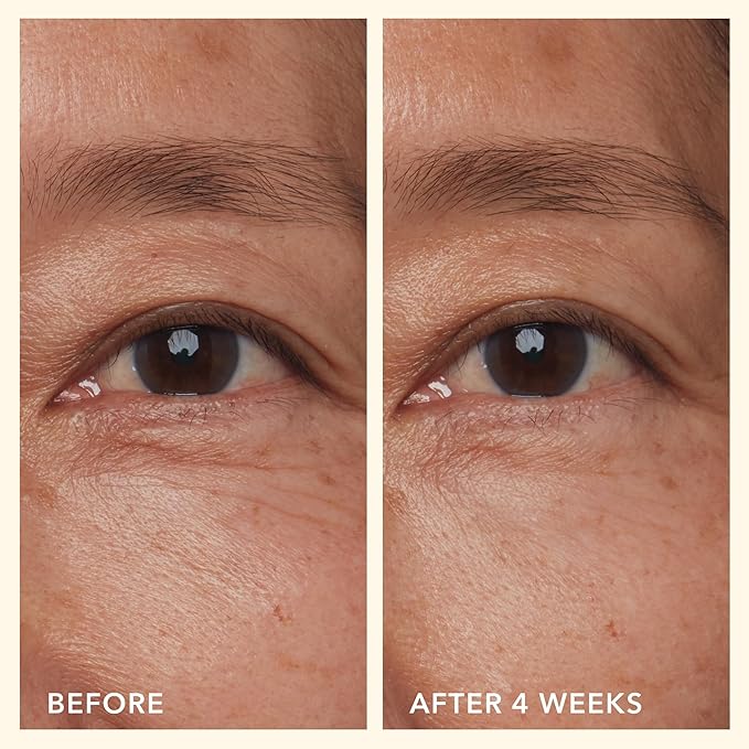 Beekman 1802 Mushroom Goat Milk Eye Cream - Clinically Proven Anti-Aging Eye Treatment for Under-Eye Circles & Fine Lines - With Hexapeptide and Snow Mushrooms - Fragrance-Free, Cruelty-Free