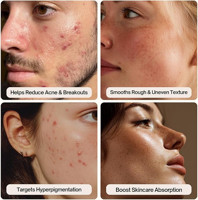 Palm Face Clean Pro⁺ - Electric Face Scrubber for Acne - IPX7 Waterproof and Rechargeable Silicon Face Exfoliator with Slip-Free Grip, 3 Speed Setting - Free from phthalates - Forest