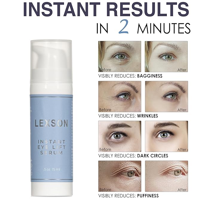 Instant Eye Lift Serum - Provides Immediate Visible Results, Lifts Away Appearance of Lines & Wrinkles. Dark Circles Under Eye Treatment, Eye Cream for Dark Circles and Puffiness