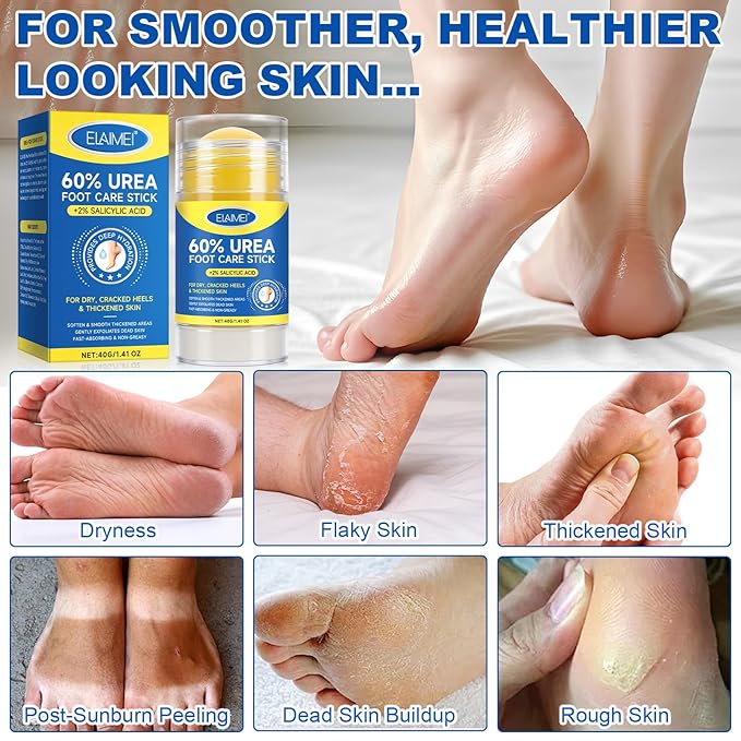 60% Urea Foot Cream for Cracked Heels, Maximum Strength 2% Salicylic Acid, Fast Absorbing, Intensive Moisturizing Foot Repair for Dry, Rough Skin & Callus Remover for Feet, 2 Sticks
