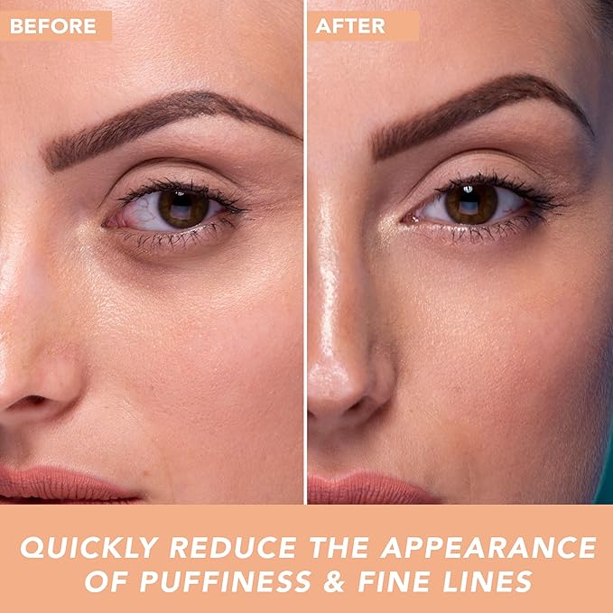 Hyaluronic Acid Eye Cream - USA Made with Natural & Organic Ingredients, Cooling Under Eye Gel & Brightener, Dark Circles Treatment with Hyaluronic Acid & Glycerin, Reduces Puffiness & Bags Under Eyes