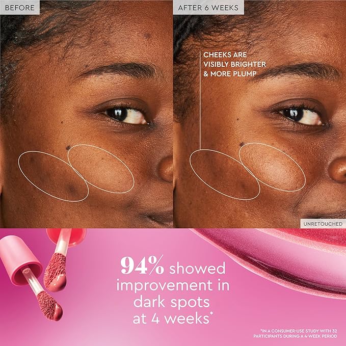 Glow Recipe Niacinamide Dewy Flush Tinted Liquid Blush Serum - Glowy Blush for Cheeks to Smooth, Hydrate & Brighten - Liquid Korean Makeup with Buildable Soft Pink Tint - Cherry Flush (0.4 oz)