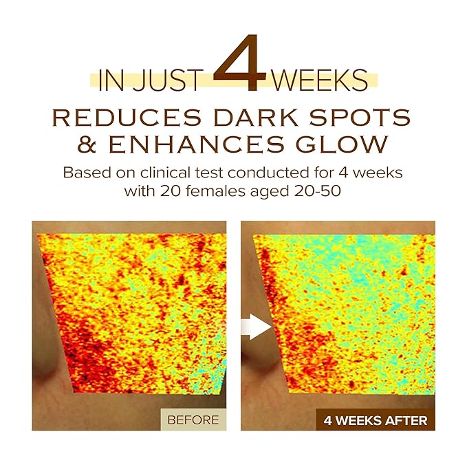 Dark Spot Ampoule | Korean Clinic Skincare - NAD+ 0.1% & Thioctic Acid 0.01% & Niacinamide 10% | Overnight Treatment for Melasma, Hyperpigmentation, Discoloration, Acne Scars | 15ml/0.33 Fl Oz