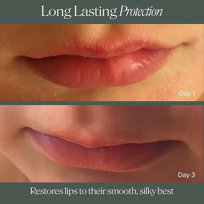 Doctor Rogers Lip Balm, Hydrating and Softening Lip Moisturizer For Very Dry Lips, Dermatologist-Created, Natural, & Hypoallergenic Moisturizing Lip Balms, 4.25g Tube