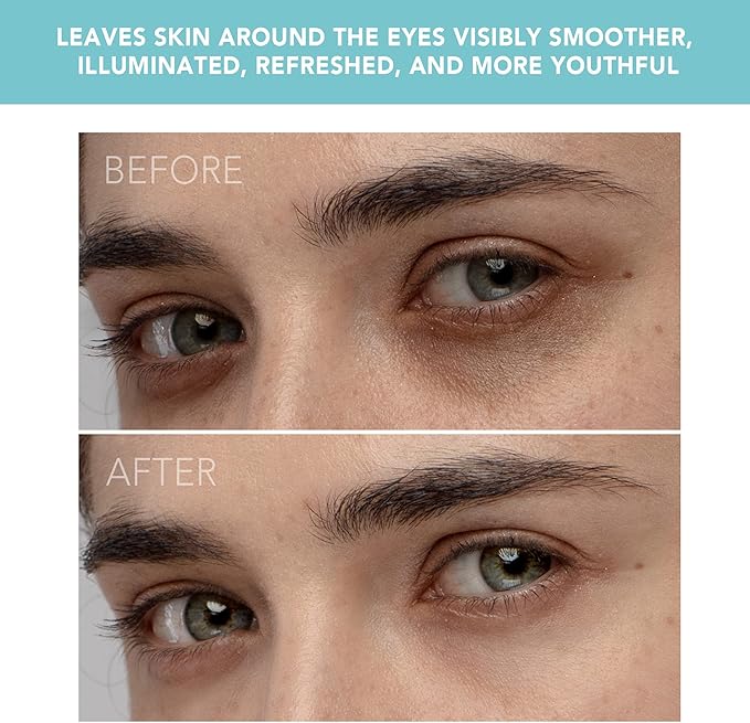 FOREO IRIS Eye Massager Dark Circle Remover & Eyebag Remover Eye Depuffer Anti Aging Increases Absorption of Eye Mask Essences| Waterproof 2-year Warranty Mint