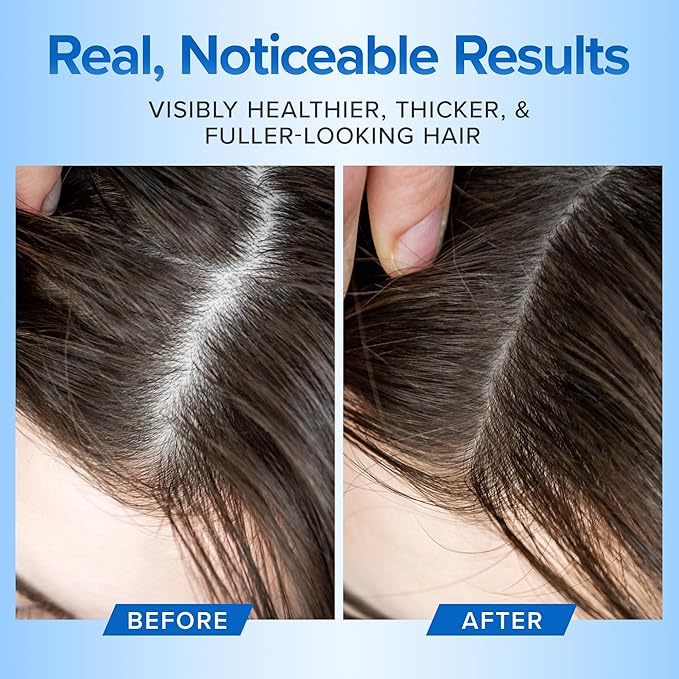 Hair Growth Shampoo for Thinning Hair and Hair Loss - Volumizing and Thickening Sulfate-Free Formula for Men and Women - Enhances Shine and Body for Color-Treated Hair with Aloe Vera (8oz)