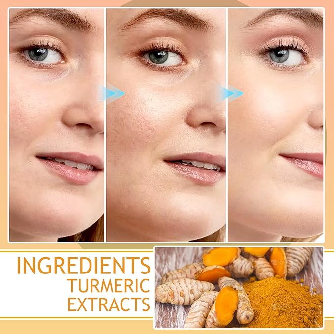 Turmeric Skin Care Set,Facial Kit with Facial Cleanser,Toner,Eye Cream,Face Serum,Honey Lip Balm,Face Cream,Lotion & 3PCS Honey Mask,Travel Skincare Kit for Women (9PCS)