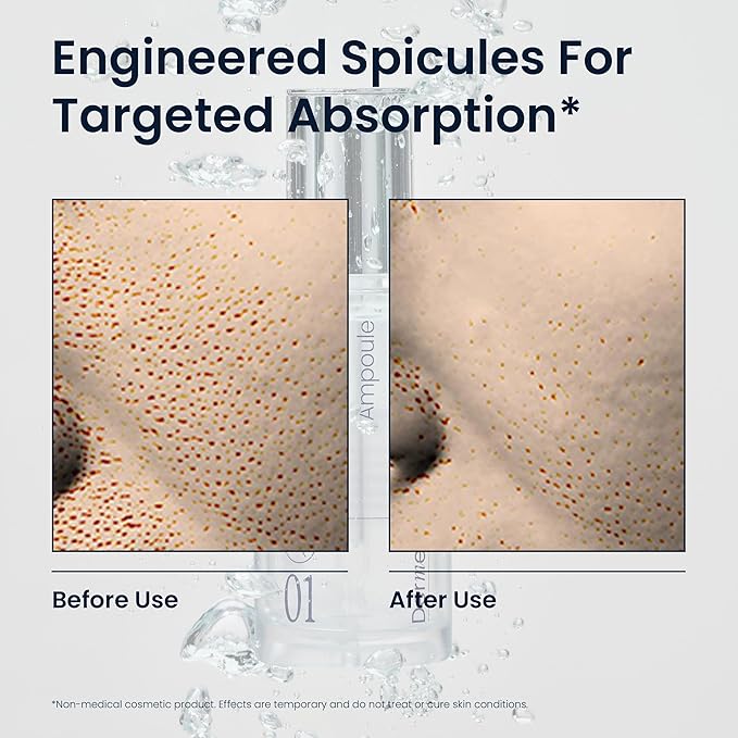 PDRN Spicule Ampoule 1.69 fl oz, Pore-Tightening Serum with 1000ppm Spicules, Centella & Hyaluronic Acid for Sensitive & Acne-Prone Skin | Home Derma Care Treatment, K-beauty Skincare