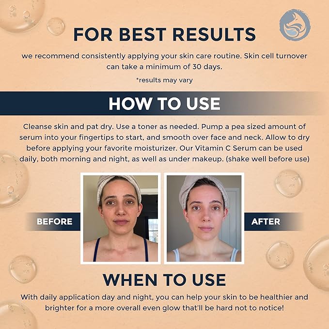 Foxbrim Naturals Vitamin C Face Serum 1oz – Stable Formula with Botanical Hyaluronic & Organic Jojoba for Dark Spots, Radiance, Hydration & Even Tone – Vegan Clean Beauty for Sensitive Skin, USA-Made