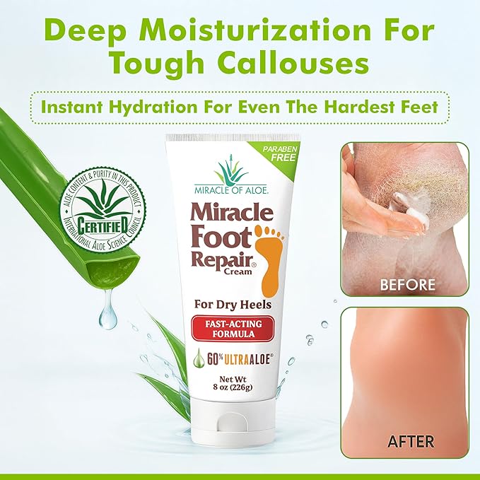 Miracle Foot Repair Cream (8 oz / 3-Pack) Repairs Dry Cracked Heels and Feet, 60% Pure UltraAloe Moisturizes, Softens, and Repairs