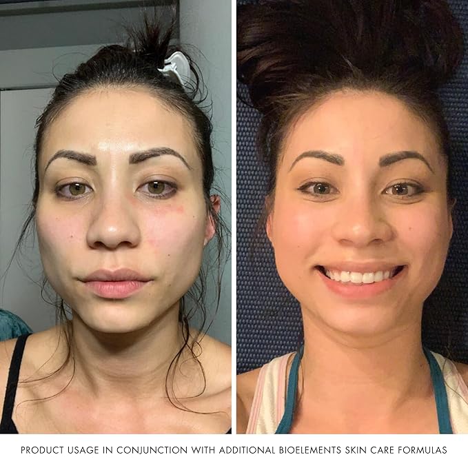 Bioelements Flash Foam Cleanser - 6.5 fl oz - Exfoliating Foam Cleanser for Oily, Combination & Dry Skin - Vegan, Gluten Free