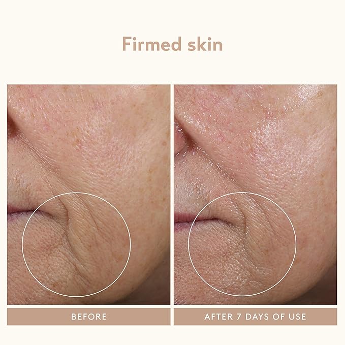 SHANI DARDEN SKIN CARE Facial Sculpting Wand, Neck Firming and Tightening Device, Anti-Aging Sound Wave Device to Target Wrinkles, For Eyes, Lips and Face, 1 Count