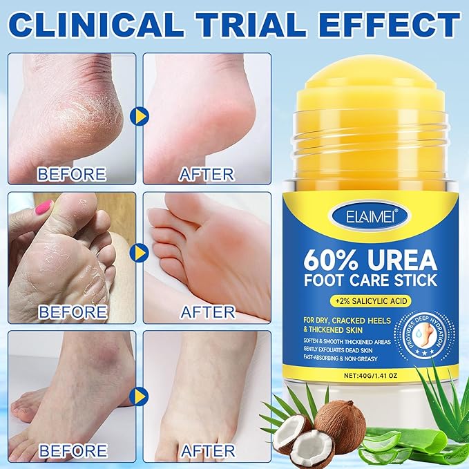 60% Urea Foot Cream for Cracked Heels, Maximum Strength 2% Salicylic Acid, Fast Absorbing, Intensive Moisturizing Foot Repair for Dry, Rough Skin & Callus Remover for Feet, 2 Sticks