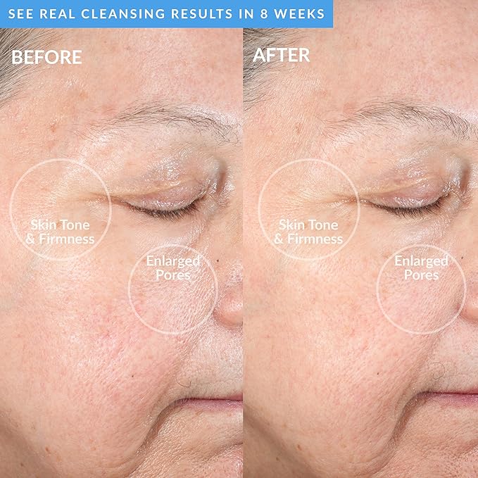 PMD Beauty Facial Cleansing Brush - Smart Silicone Brush with Blue Light Treatment - SonicGlow Vibration - Waterproof Device for Acne