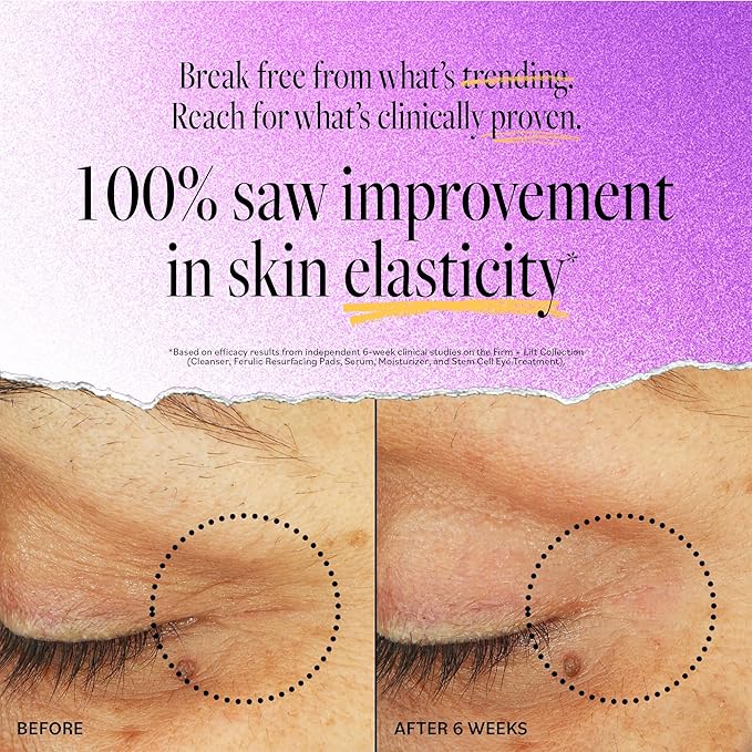 Derma e stem cell lifting