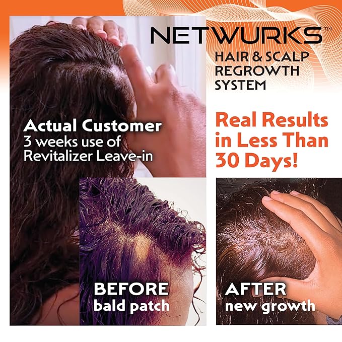 Hair & Scalp Regrowth Oil, Pure Rosemary, Coconut Oil, Biotin & Mucopolysaccharides, (polysaccharide/sugar polymer), Repairs & Promotes Hair Growth, Revitalizing Serum, 2 oz