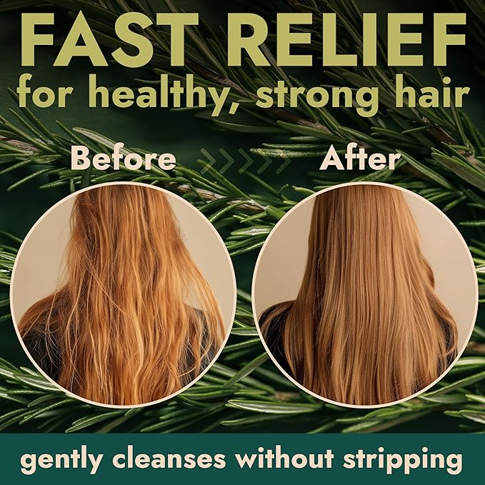 Rosemary Shampoo and Conditioner Set Infused with Tea Tree & Rosemary Oils for Scalp Relief and Hair Growth | Sulfate Free, Soothes Dry Scalp, Boosts Shine + Free Scalp Brush | 16.9 fl oz