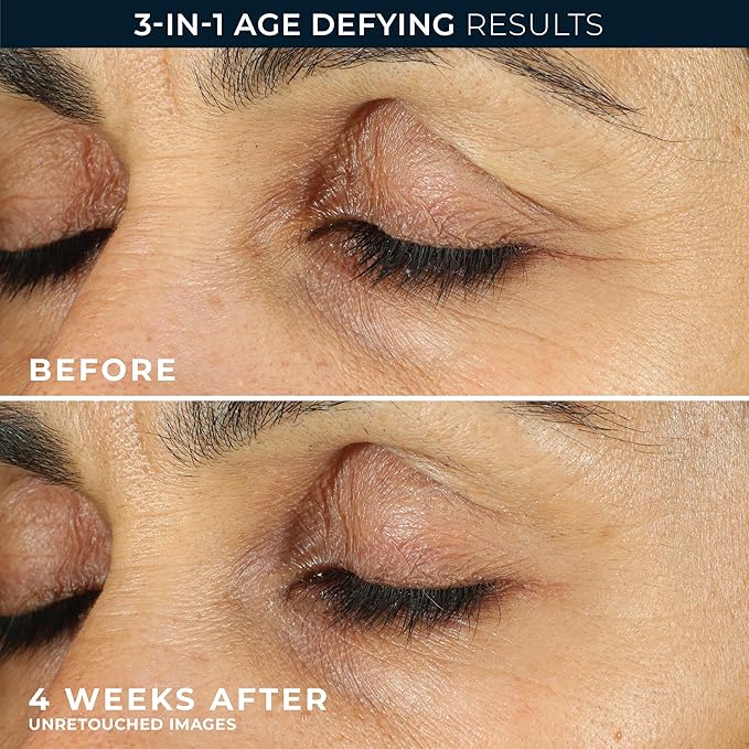 RoC Retinol Correxion Under Eye Cream for Dark Circles & Puffiness, Daily Wrinkle Cream, Anti Aging Line Smoothing Skin Care Treatment for Women and Men, 0.5 oz (Packaging May Vary)