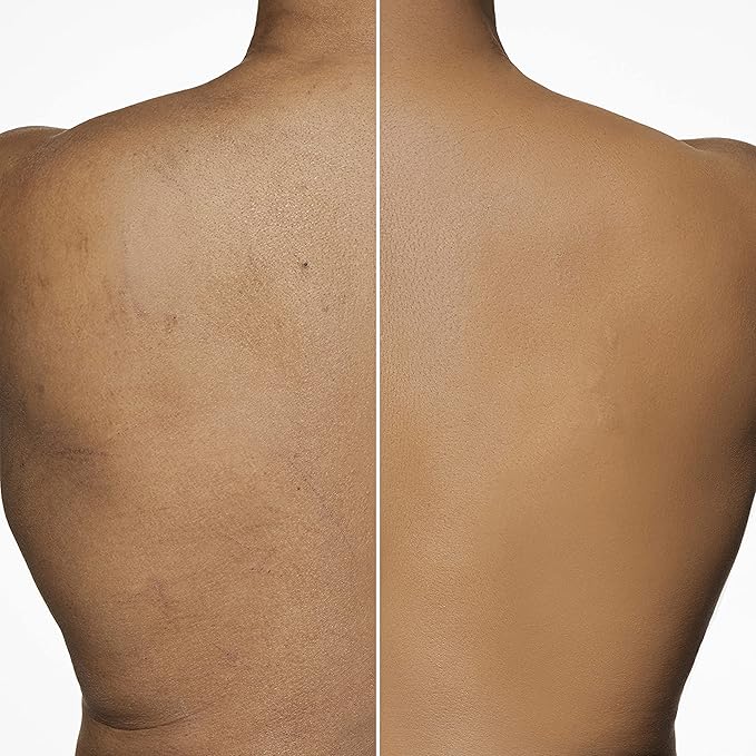 Dermablend Leg and Body Makeup Foundation with SPF 25, 20N Light Natural, 3.4 Fl. Oz.