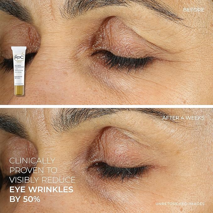 RoC Retinol Correxion Line Smoothing Eye Cream + Retinol Serum Capsules For Night + Max Hydration Crème With Hyaluronic Acid For Day, Skin Care Routine for Women and Men