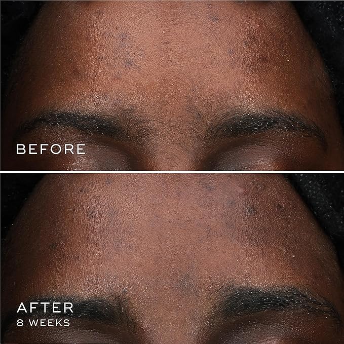 Medik8 Oxy-R Peptides Serum - Dark Spot Corrector With Twin Peptides - Face Serum For Women and Men - Gentle on Sensitive Skin - Gluten Free - 0.3 oz